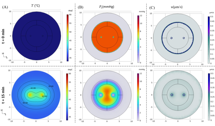 The Role of Ultrasound in Modulating Interstitial Fluid Pressure in Solid  Tumors for Improved Drug Delivery