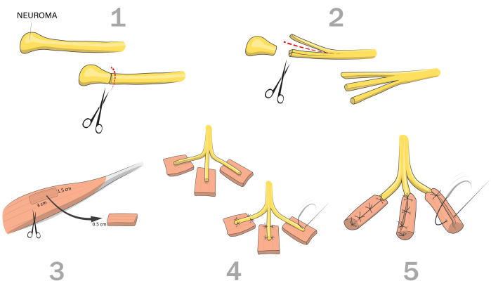 figure-protocol-5550