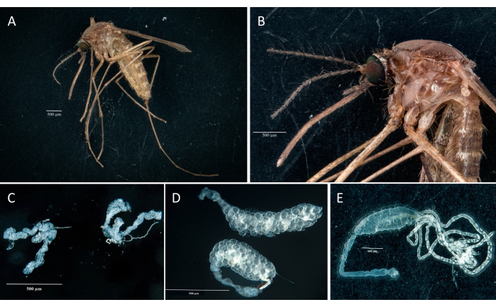 Dissection of Mosquito Ovaries, Midgut, and Salivary Glands for ...